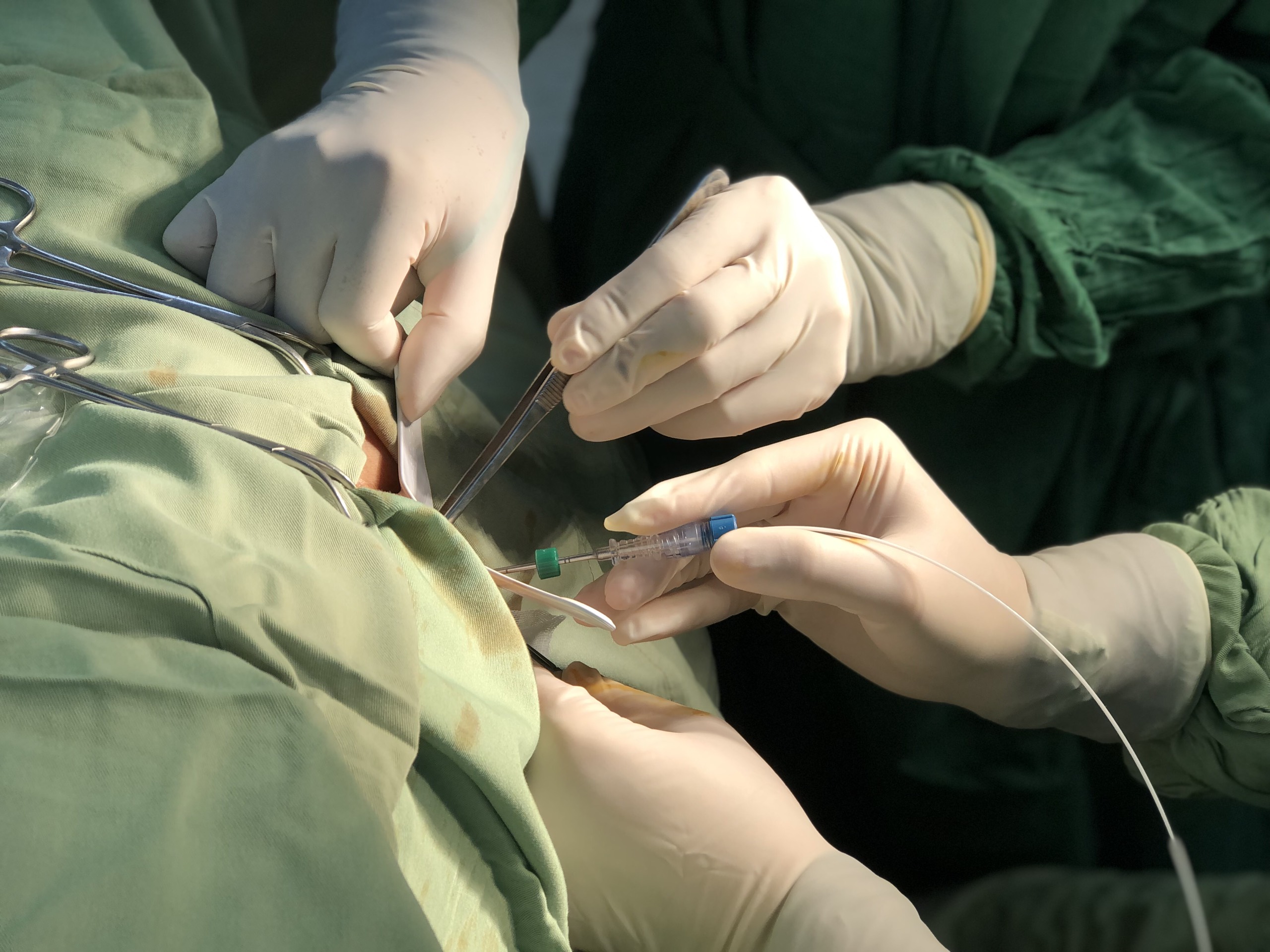 Trải nghiệm thực tế quy trình điều trị trĩ bằng laser tại Hà Thành Medic 
