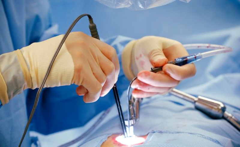 Laser điều trị trĩ tại Quy Nhơn